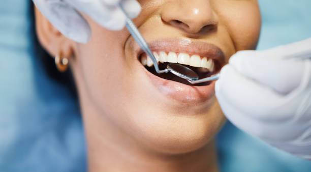 Best Chipped Tooth Repair Near Me  in Harbor Bluffs, FL