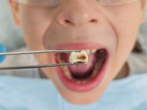 Best Emergency Gum Pain Relief  in Harbor Bluffs, FL