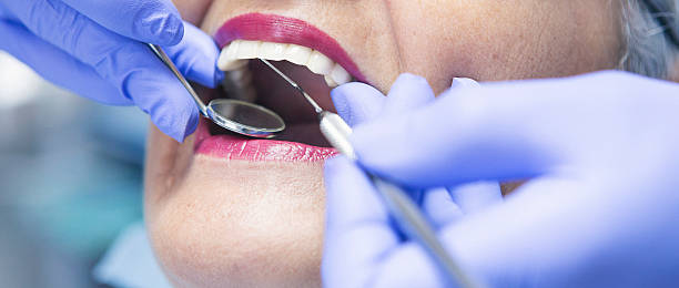 Best Tooth Infection Emergency Dentist  in Harbor Bluffs, FL